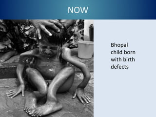 NOW
Bhopal
child born
with birth
defects
 