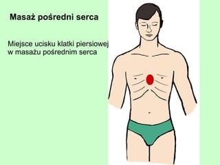 promieniowanie (jonizujące, podczerwone, nadfioletowe, laserowe) 