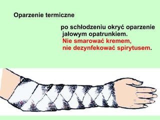 Czynniki środowiska pracy   obciążenie fizyczne (statyczne i dynamiczne) 