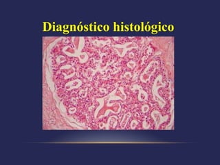 Diagnóstico histológico
 