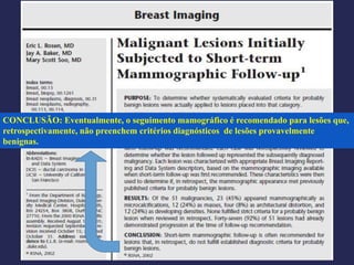 CONCLUSÃO: Eventualmente, o seguimento mamográfico é recomendado para lesões que,
retrospectivamente, não preenchem critérios diagnósticos de lesões provavelmente
benignas.
 