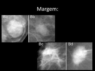 Margem:
 