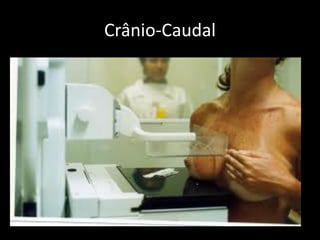 Crânio-Caudal
 