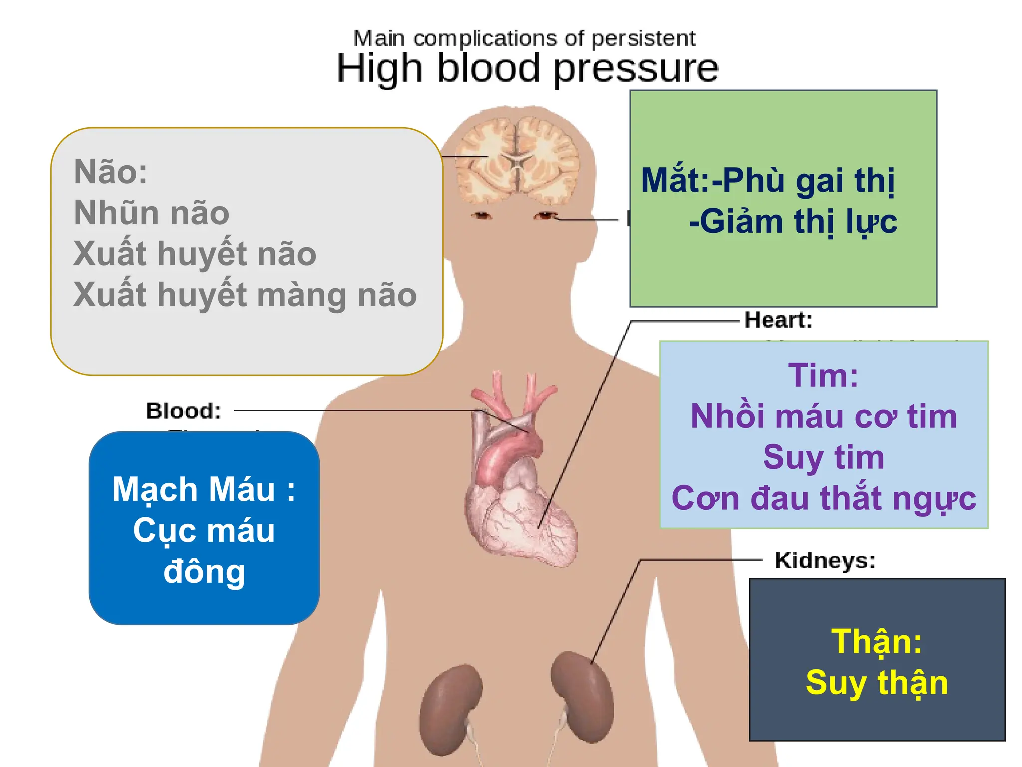 Mắt:-Phù gai thị
-Giảm thị lực
Tim:
Nhồi máu cơ tim
Suy tim
Cơn đau thắt ngực
Thận:
Suy thận
Não:
Nhũn não
Xuất huyết não
Xuất huyết màng não
Mạch Máu :
Cục máu
đông
 