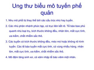 Ung thư biểu mô tuyến phế
quản
1. Nhu mô phổi bị thay thế bởi các cấu trúc nhú hay tuyến.
2. Các nhú phân nhánh phức tạp, có trục liên kết rõ. Tế bào bao phủ
quanh nhú loại trụ, kích thước không đều, nhân lớn, mất cực tính,
ưa kiềm, chất nhiễm sắc thô.
3. Các tuyến có kích thước không đều, méo mó hoặc không rõ hình
tuyến. Các tế bào tuyến mất cực tính, có vùng nhiều hàng. nhân
lớn, mất cực tính, ưa kiềm, chất nhiễm sắc thô.
4. Mô đệm tăng sinh xơ, có xâm nhập tế bào viêm một nhân.
 