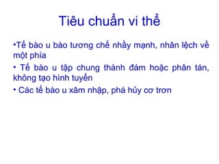 Tiêu chuẩn vi thể
•Tế bào u bào tương chế nhầy mạnh, nhân lệch về
một phía
• Tế bào u tập chung thành đám hoặc phân tán,
không tạo hình tuyến
• Các tế bào u xâm nhập, phá hủy cơ trơn
 