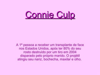 Connie Culp A 1ª pessoa a receber um transplante de face nos Estados Unidos, após ter 80% do seu rosto destruído por um tiro em 2004 disparado pelo próprio marido. O projétil atingiu seu nariz, bochecha, maxilar e olho.   