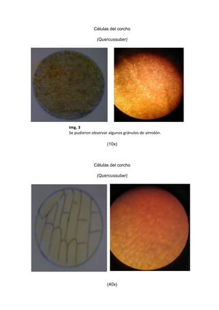 Células del corcho
(Quercussuber)

Img. 3
Se pudieron observar algunos gránulos de almidón.
(10x)

Células del corcho
(Quercussuber)

(40x)

 