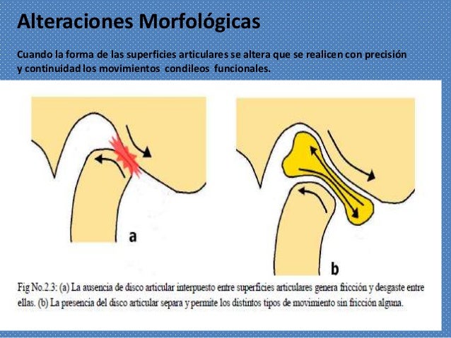 Como distinguir la osteocondrosis de las enfermedades de los órganos interiores