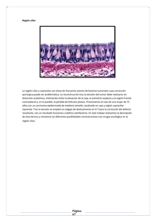 Página
67
Región ciliar
La región ciliar y supraciliar son áreas de frecuente asiento de lesiones tumorales cuya correcció...