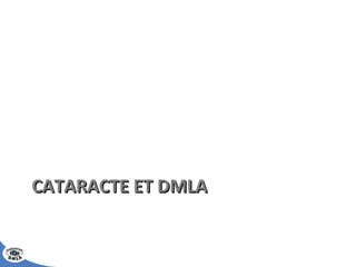CATARACTE ET DMLA 