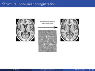 Structural non-linear coregistration
P. Bellec Mining brain networks Montr´eal 2016 5 / 34
 