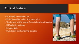 Clinical feature
• Acute pain on tendon part .
• Patients unable to flex the knee joint.
• Tenderness at the biceps femoris long head tendon
• Difficulty in walking.
• Limping gait.
• Swelling at the hamstring muscles.
 