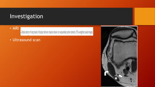 Investigation
• MRI
• Ultrasound scan
 