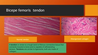 Bicepe femoris tendon
Normal tendon Disorganized collagen
A tendon or sinew is a tough band of fibrous connective tissue that
connects muscle to bone and is capable of withstanding
tension. Tendons are similar to ligaments; both are made of
collagen.
 