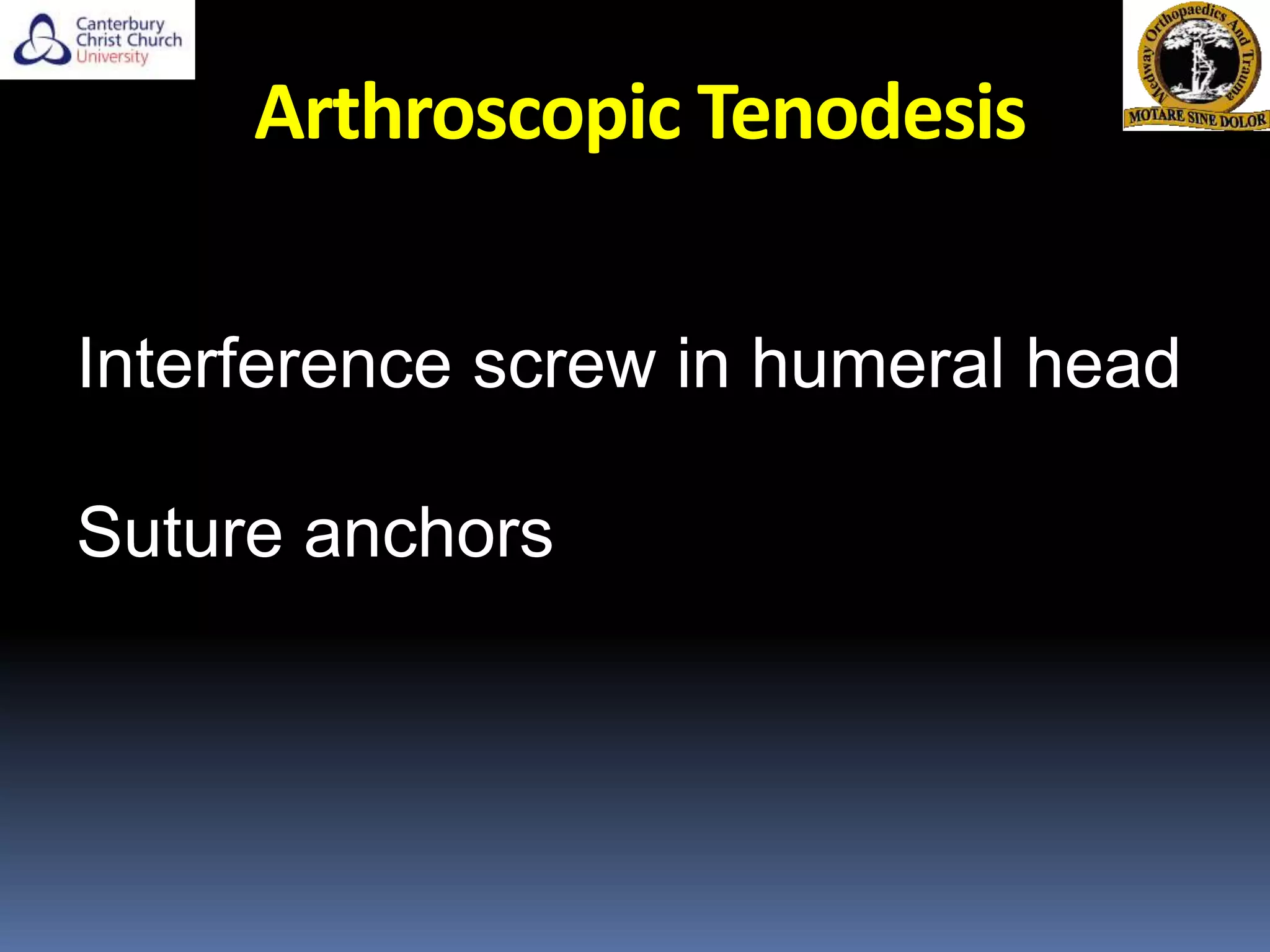 Arthroscopic Tenodesis
Interference screw in humeral head
Suture anchors
 