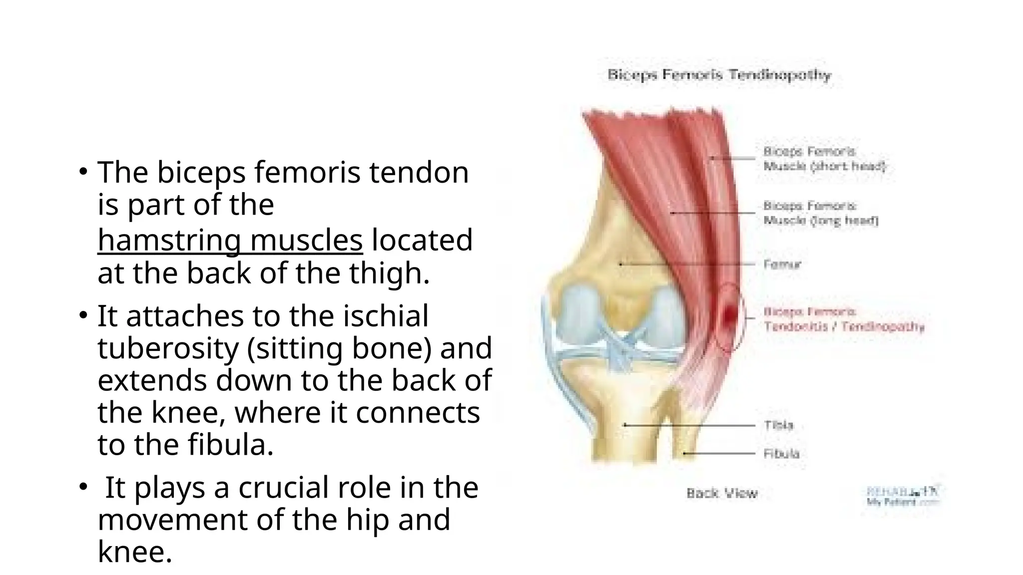 Biceps Femoris Rabbit What Is Biceps Femoris Tendonitis