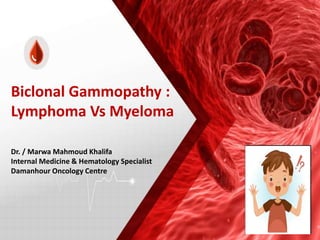 Dr. / Marwa Mahmoud Khalifa
Internal Medicine & Hematology Specialist
Damanhour Oncology Centre
Biclonal Gammopathy :
Lymphoma Vs Myeloma
 