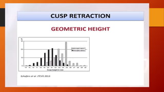 Bicuspid aortic valve 