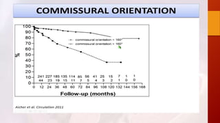 Bicuspid aortic valve 