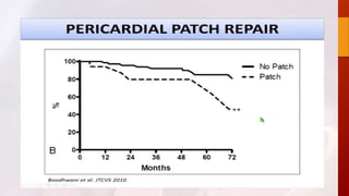 Bicuspid aortic valve 