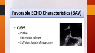 Bicuspid aortic valve 
