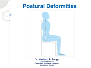 Dr. Madhuri P. Sadgir
Assistant Professor
Department of Physical Education
University of Mumbai
Postural Deformities
 
