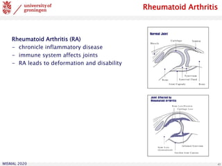 WISMAL 2020 45
Rheumatoid Arthritis
Rheumatoid Arthritis (RA)
- chronicle inflammatory disease
- immune system affects joints
- RA leads to deformation and disability
 