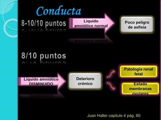 Juan Haller capitulo 4 pág. 60
 