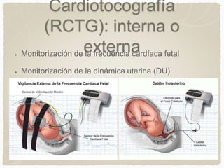 R Ctg Bienestar fetal | PPTX