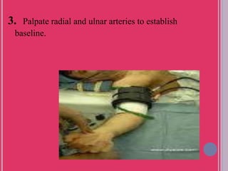 3. Palpate radial and ulnar arteries to establish
baseline.
 