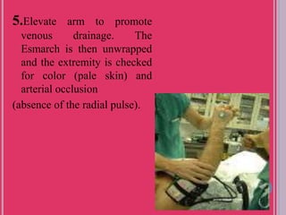 5.Elevate arm to promote
venous drainage. The
Esmarch is then unwrapped
and the extremity is checked
for color (pale skin) and
arterial occlusion
(absence of the radial pulse).
 