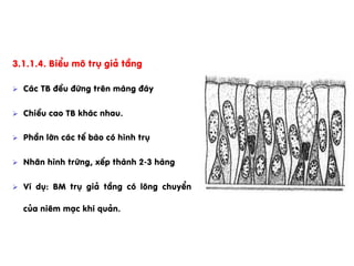 3.1.1.4. BiÓu m« trô gi¶ tÇng
Ø  C¸c TB ®Òu ®øng trªn mµng ®¸y
Ø  ChiÒu cao TB kh¸c nhau.
Ø  PhÇn lín c¸c tÕ bµo cã h×nh trô
Ø  Nh©n h×nh trøng, xÕp thµnh 2-3 hµng
Ø  VÝ dô: BM trô gi¶ tÇng cã l«ng chuyÓn
cña niªm m¹c khÝ qu¶n.
 