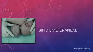 BIFIDISMO CRANEAL
AKEMI TICLAVILCA CH.
 