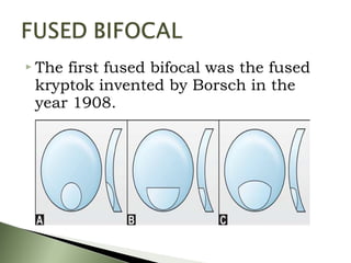  The first fused bifocal was the fused
kryptok invented by Borsch in the
year 1908.
 