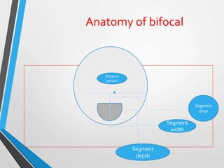 Anatomy of bifocal
Segment
width
Segment
depth
Segment
drop
Distance
portion
 