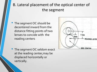 B. Lateral placement of the optical center of
the segment
• The segment OC should be
decentered inward from the
distance fitting points of two
lenses to concide with the
reading centers
• The segment OC seldom exact
at the reading center,may be
displaced horizontally or
vertically.
 
