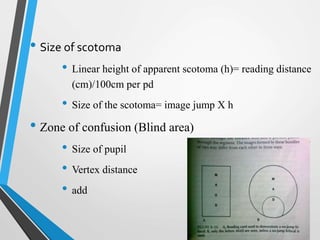 • Size of scotoma
• Linear height of apparent scotoma (h)= reading distance
(cm)/100cm per pd
• Size of the scotoma= image jump X h
• Zone of confusion (Blind area)
• Size of pupil
• Vertex distance
• add
 