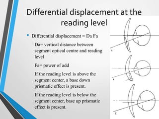 Differential displacement at the
reading level
• Differential displacement = Da Fa
Da= vertical distance between
segment optical centre and reading
level
Fa= power of add
If the reading level is above the
segment center, a base down
prismatic effect is present.
If the reading level is below the
segment center, base up prismatic
effect is present.
 