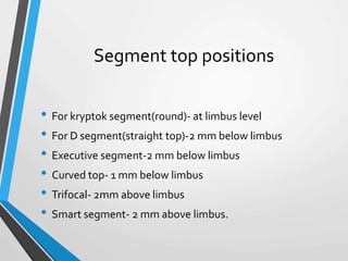 Segment top positions
• For kryptok segment(round)- at limbus level
• For D segment(straight top)-2 mm below limbus
• Executive segment-2 mm below limbus
• Curved top- 1 mm below limbus
• Trifocal- 2mm above limbus
• Smart segment- 2 mm above limbus.
 