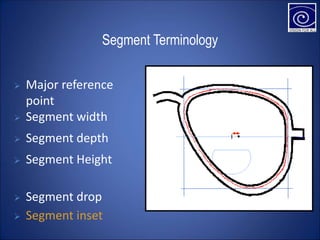 Segment Terminology
 Segment width
 Segment depth
 Segment Height
 Segment drop
 Segment inset
 Major reference
point
 