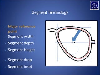 Segment Terminology
 Segment width
 Segment depth
 Segment Height
 Segment drop
 Segment inset
 Major reference
point
 