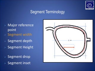 Segment Terminology
 Segment width
 Segment depth
 Segment Height
 Segment drop
 Segment inset
 Major reference
point
 