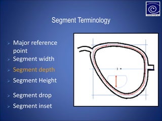 Segment Terminology
 Segment width
 Segment depth
 Segment Height
 Segment drop
 Segment inset
 Major reference
point
 