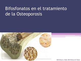 Bifosfonatos en el tratamiento
de la Osteoporosis
MD Dima L. Diab, MD Nelson B. Watts
 