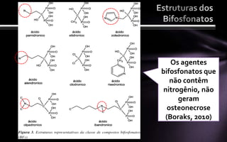 Os agentes
bifosfonatos que
   não contêm
 nitrogênio, não
      geram
  osteonecrose
 (Boraks, 2010)
 