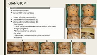 Transbasal Approach Bifrontal transbasal approach - 25 Agustus 2022 - RS AB PP.pptx