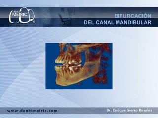 BIFURCACIÓN 
DEL CANAL MANDIBULAR 
 