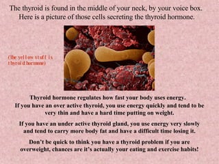 The thyroid is found in the middle of your neck, by your voice box.  Here is a picture of those cells secreting the thyroid hormone. Thyroid hormone regulates how fast your body uses energy.   If you have an over active thyroid, you use energy quickly and tend to be very thin and have a hard time putting on weight. If you have an under active thyroid gland, you use energy very slowly and tend to carry more body fat and have a difficult time losing it. Don’t be quick to think you have a thyroid problem if you are overweight, chances are it’s actually your eating and exercise habits! (The yellow stuff is thyroid hormone) 