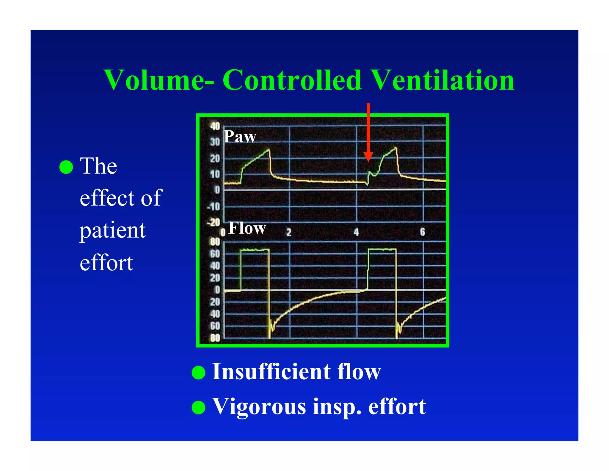 Volume- Controlled Ventilation
                 Paw
  The
  effect of
  patient        Flow

  effort



                Insufficient
                            flow
                Vigorous insp. effort
 
